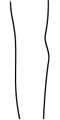 A flat buttock